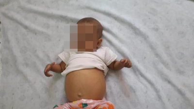 &quot;Не могу смотреть, как умирает ребенок&quot;: младенцу из Шымкента требуется пересадка печени