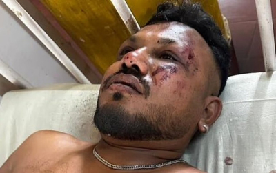Один выжил, другой нет: единственный выживший в крушении Air India пришел на похороны брата